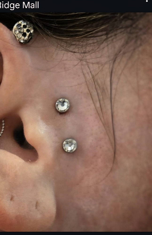 Vertical Tragus