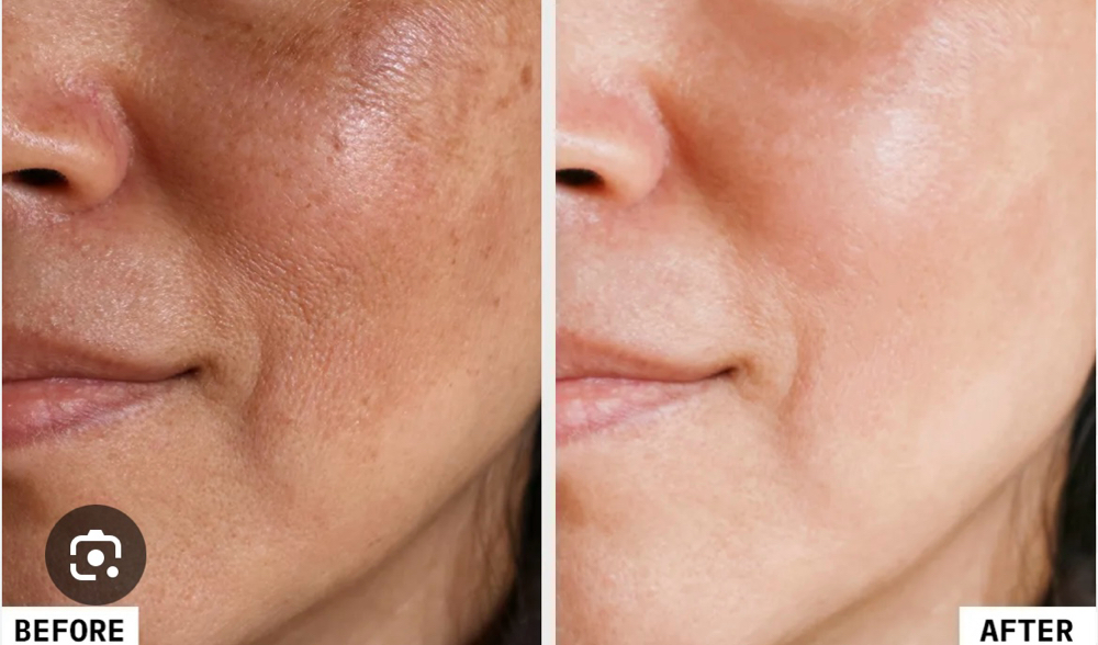 Peel Mandeliclear + Vitamin A