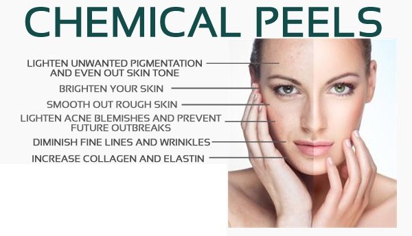 ENHANCEMENT - CHEMICAL PEEL