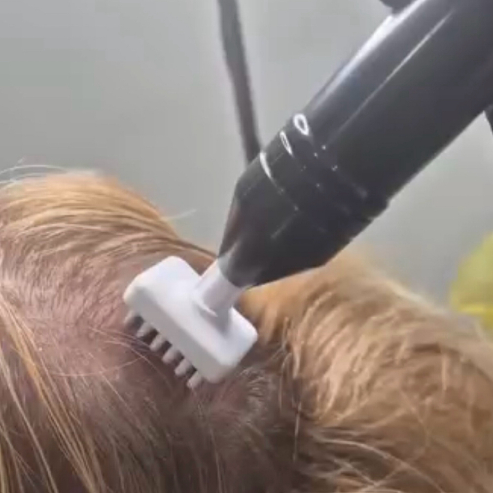 Hair Restoration at Sanazskincenter in Vienna, VA