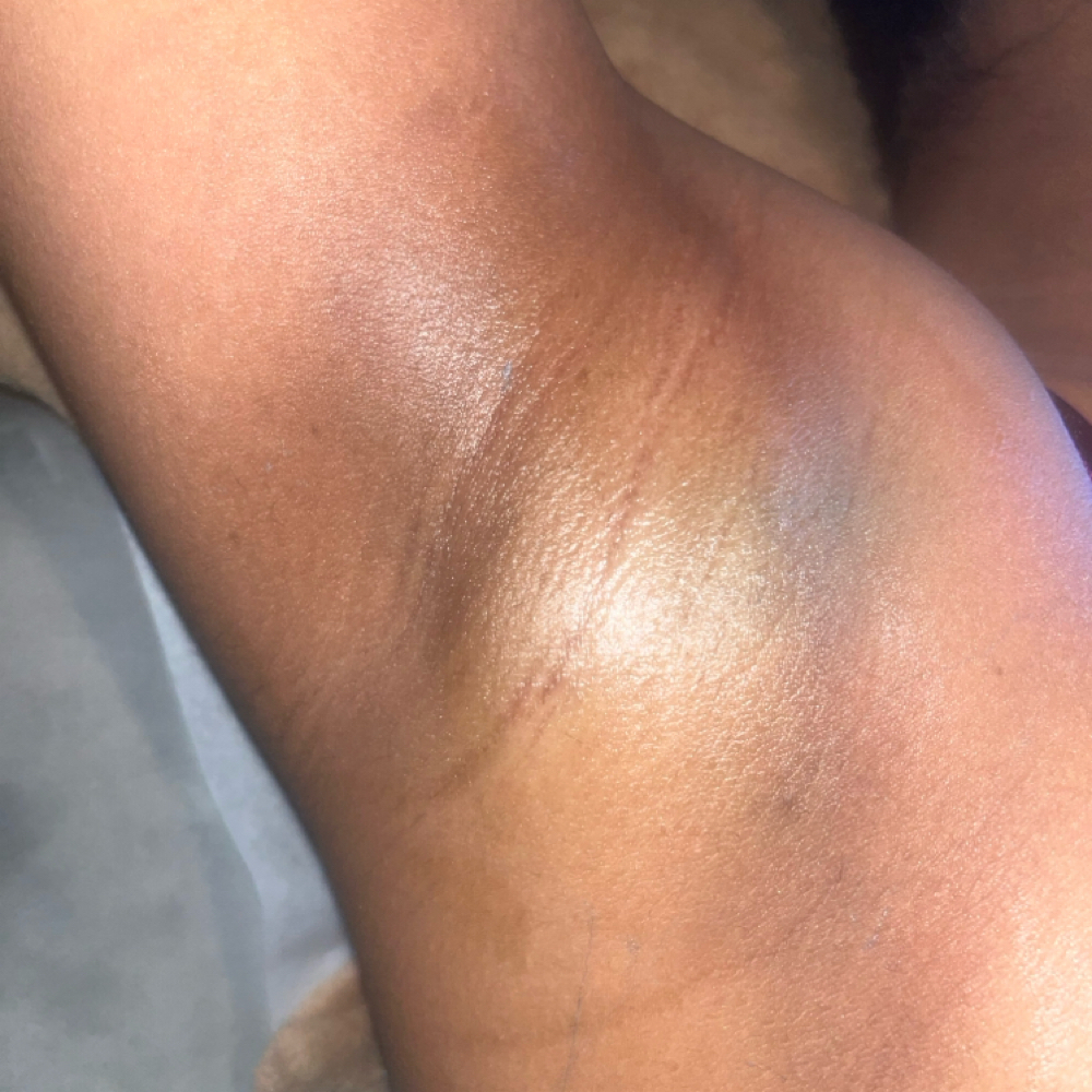 Underarm Wax at TheSkinOasis Beauty Bar in Conyers, GA