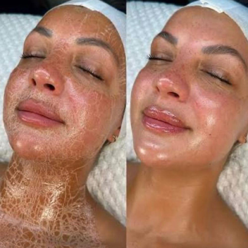 Add Circadia Peptide Firming Mask at Advanced Micro Aesthetics in Las Vegas, NV