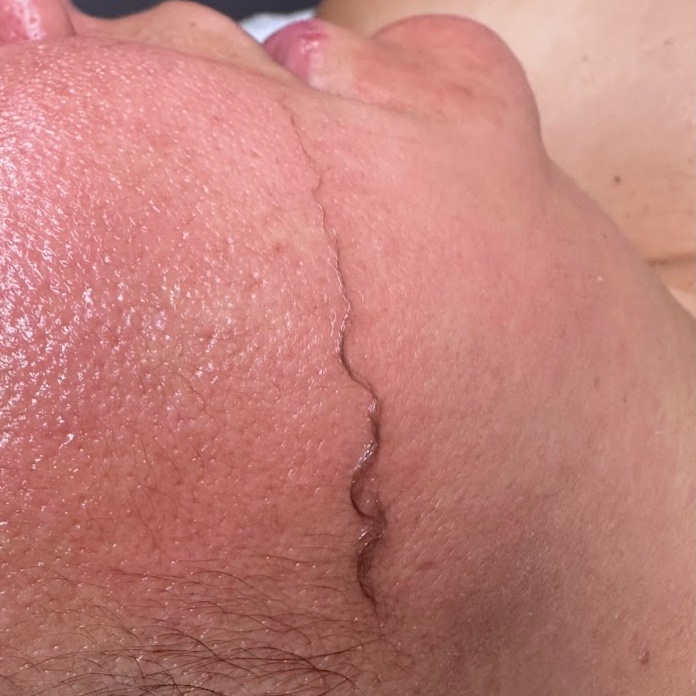 Polished Beauty (Dermaplane) at Santana Skin Studio in El Paso, TX