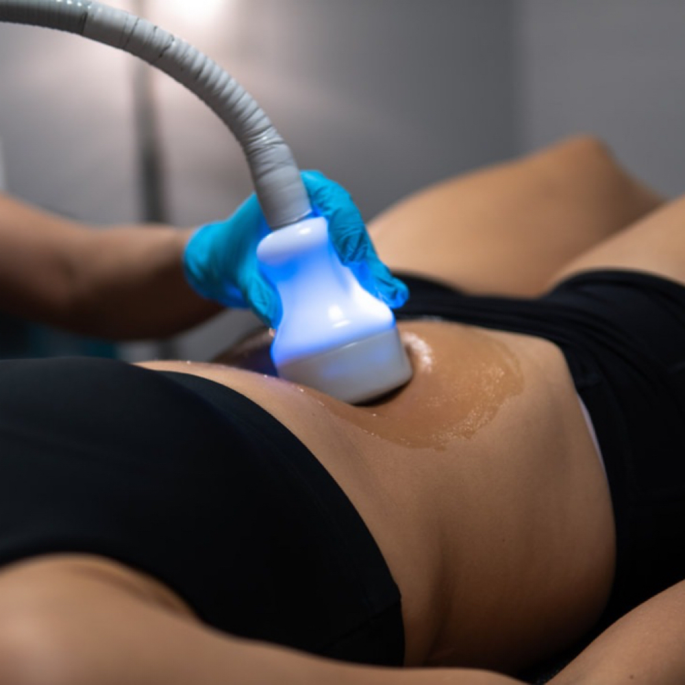 Cryo T-Shock Toning/Tightening
