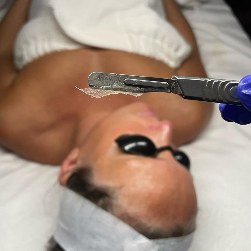 Mini Dermaplane Facial at KSHBEAUTY in Minooka, IL