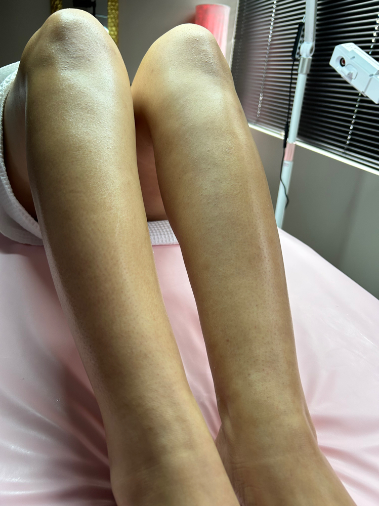 Lower Leg Wax at LaNise Aesthetics LC in Lexington, KY