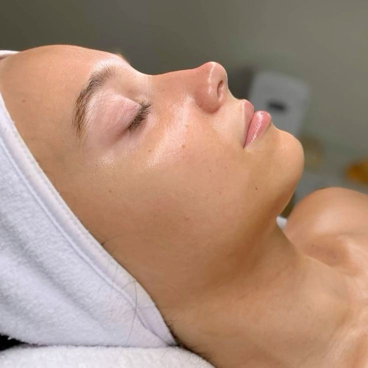 Chemical Peel 3 sessions Special