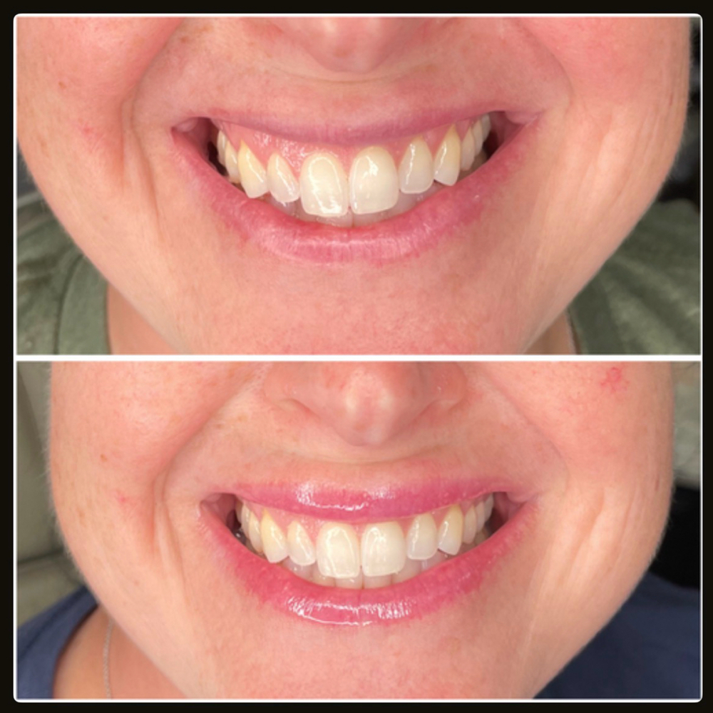 Lip Flip at Alluring Soul in Joplin, MO