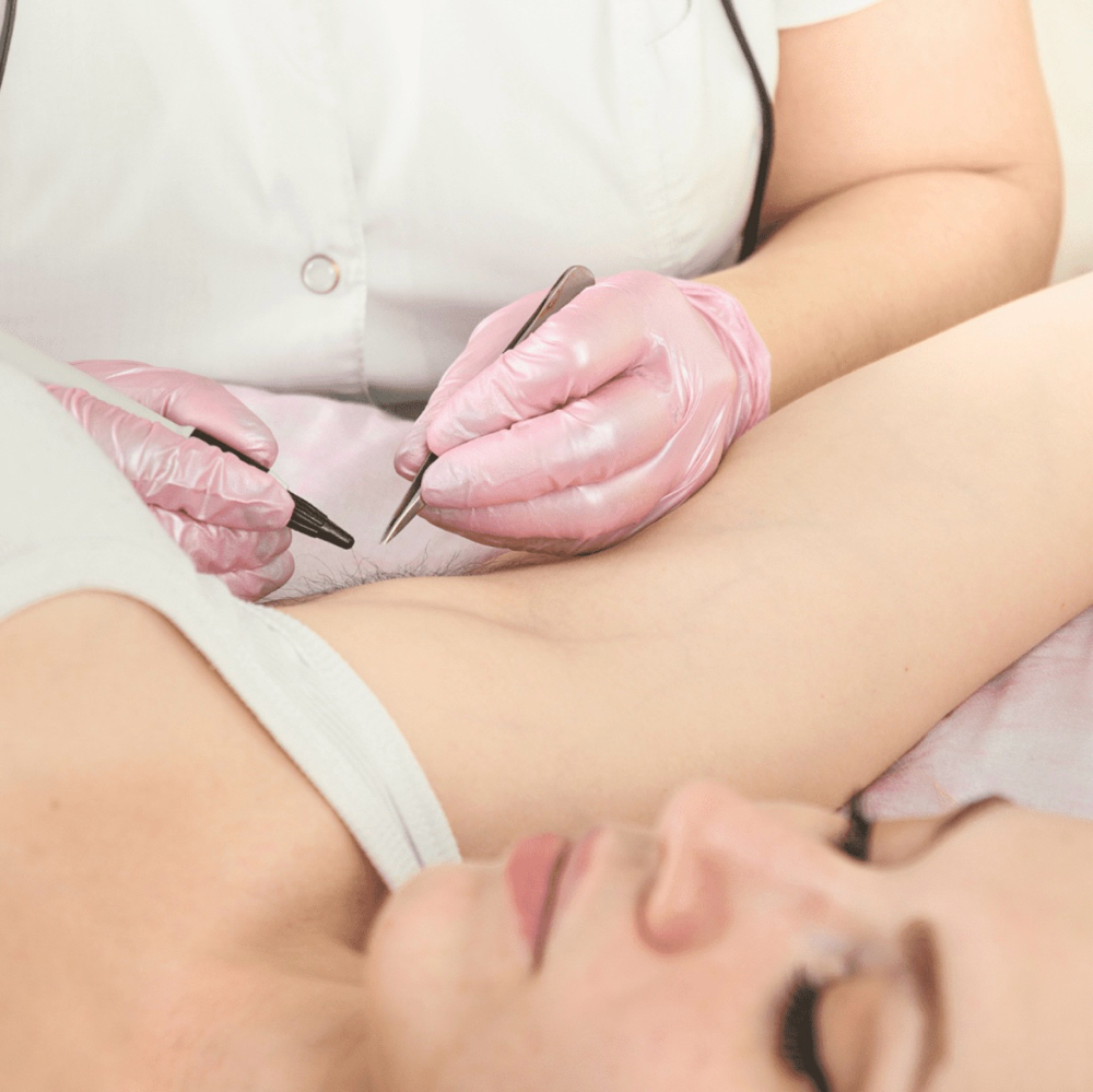 Electrolysis 60 Minute Sassion
