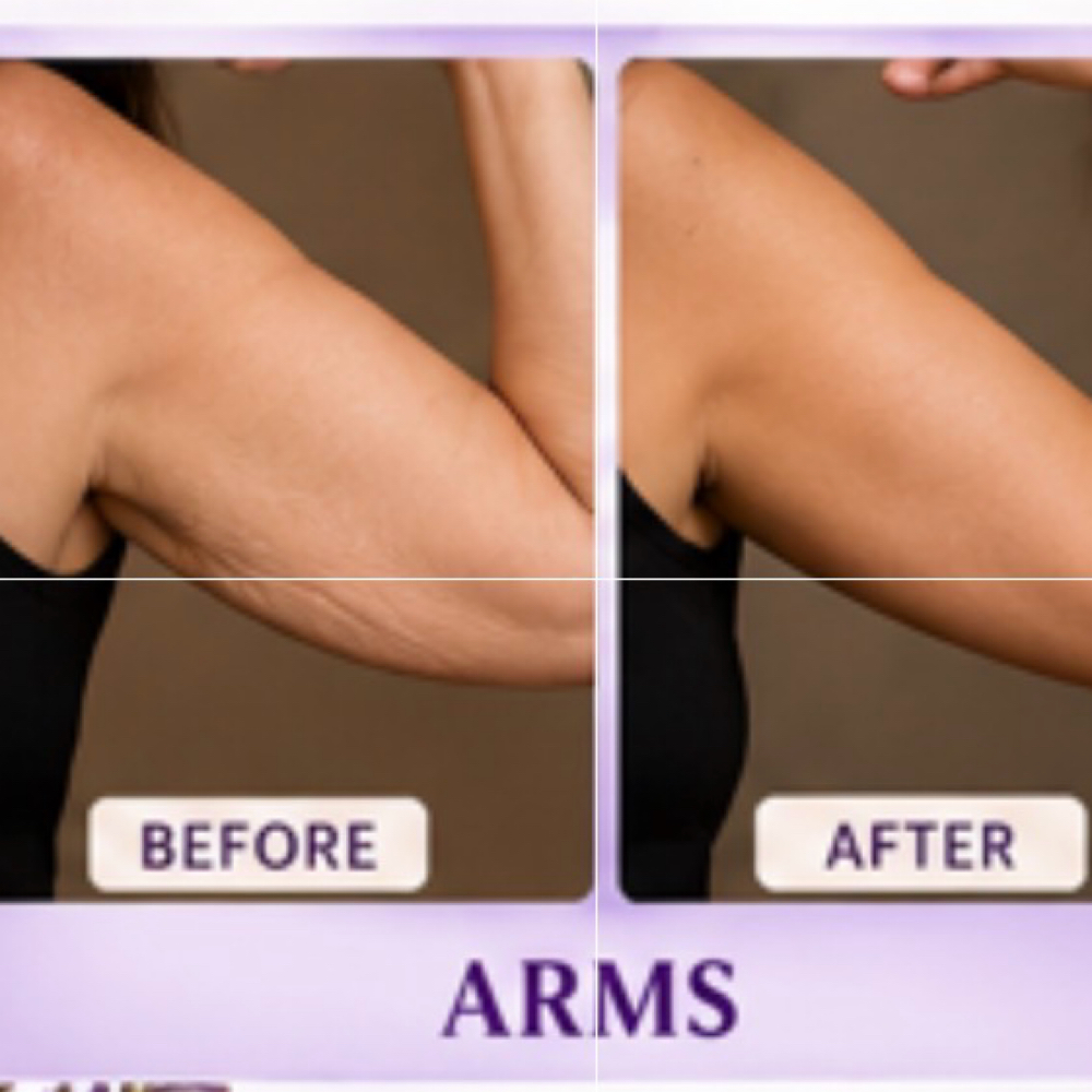 Artemis T- Shape 2 - Arms at Mirrored Image Beauty & Wellness in Oconomowoc, WI