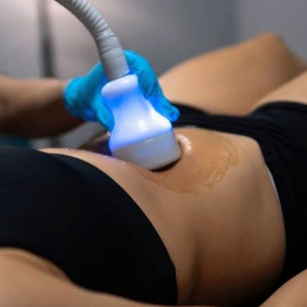 Cryotherapy Body Slimming at Top Tier Massage & Wellness LLC in Abingdon, MD