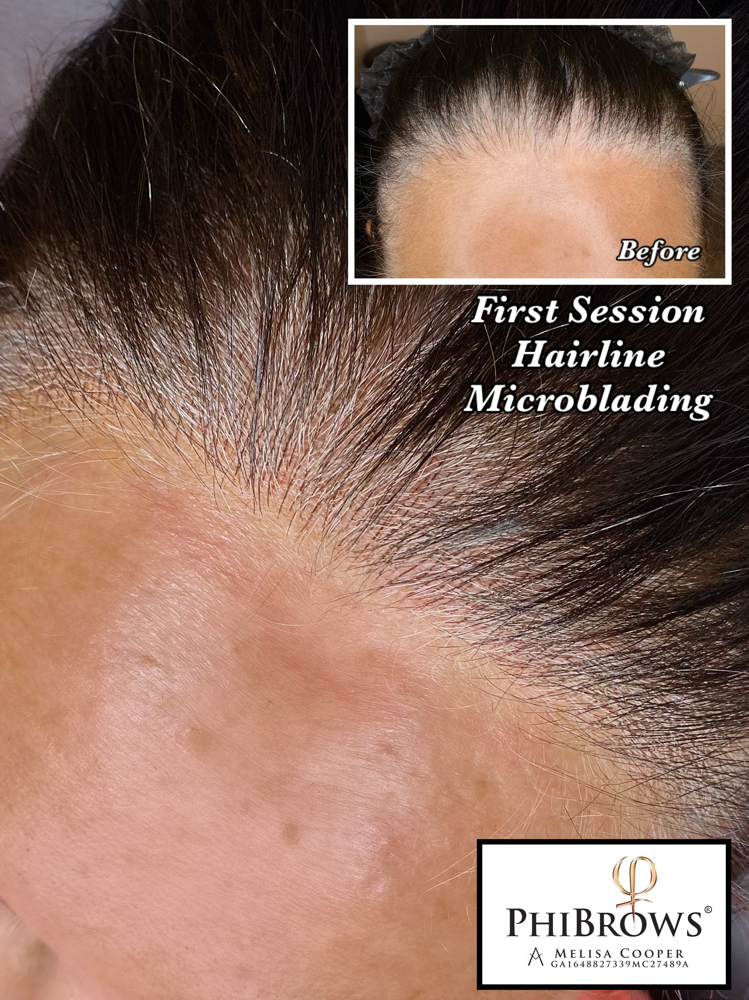 Hairline Microblading