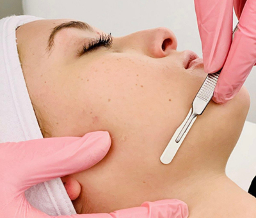 Dermaplane Facial
