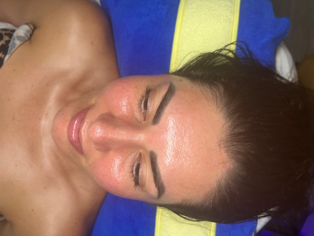 Dermaplaning