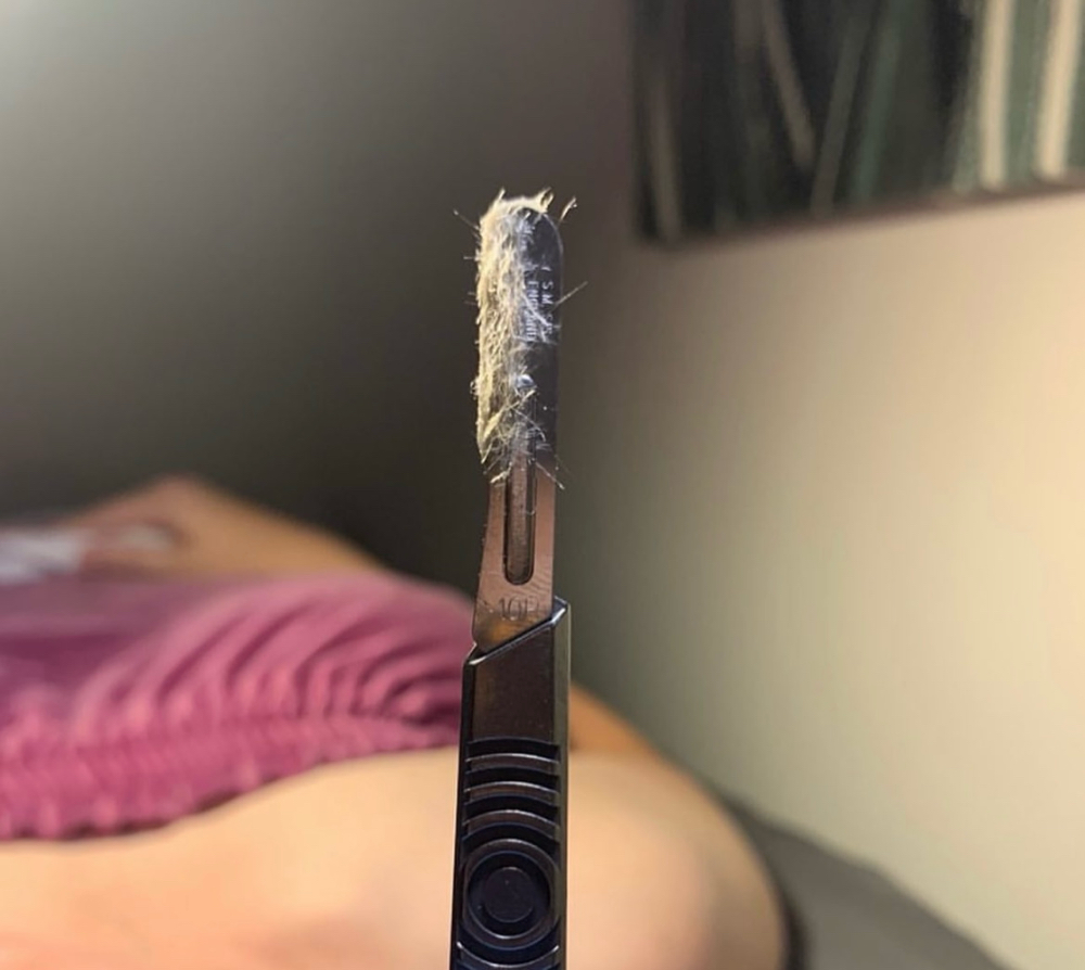 Dermaplane + Jelly Mask