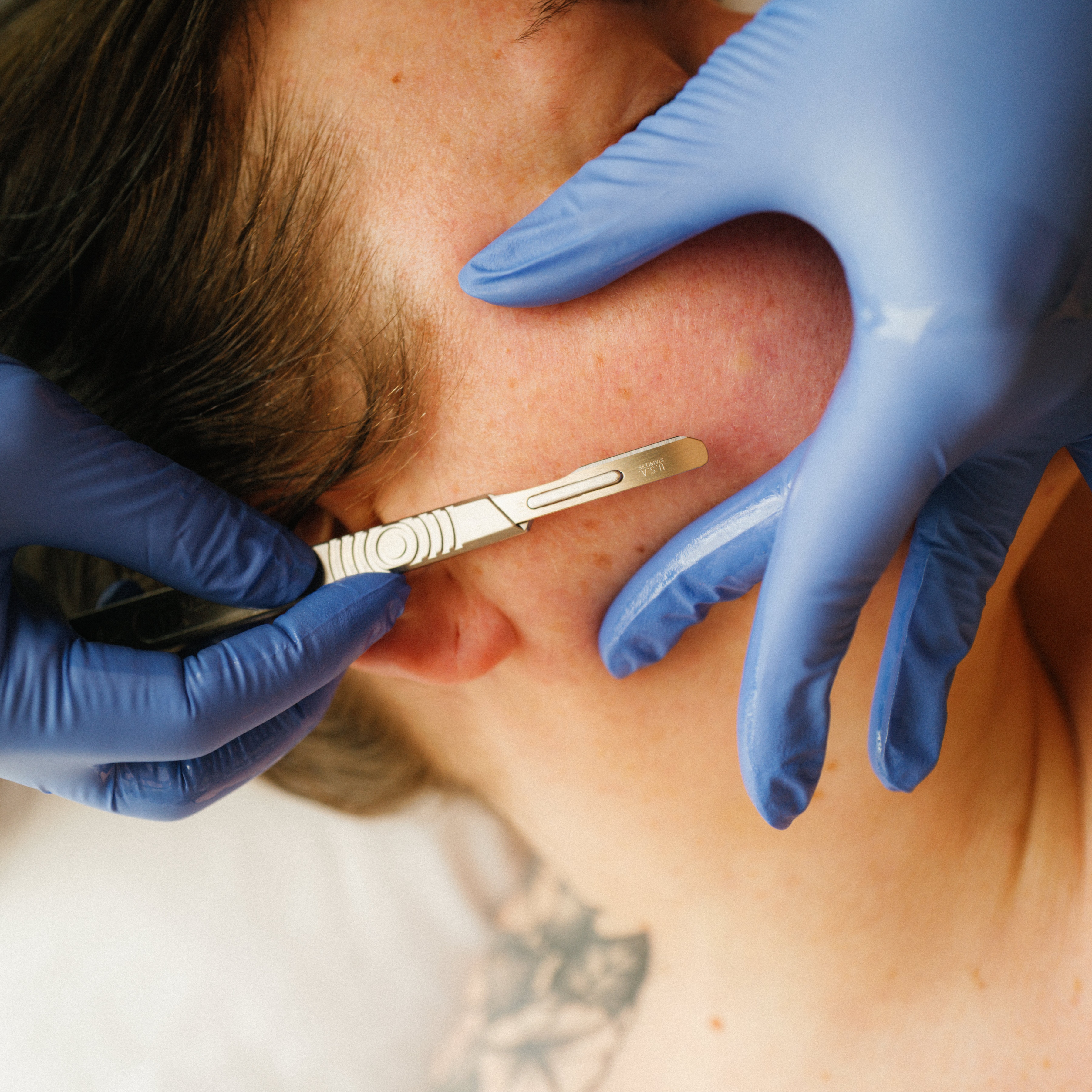 The Derm + Peel + Light at Studio Nudi in Grand Rapids, MI