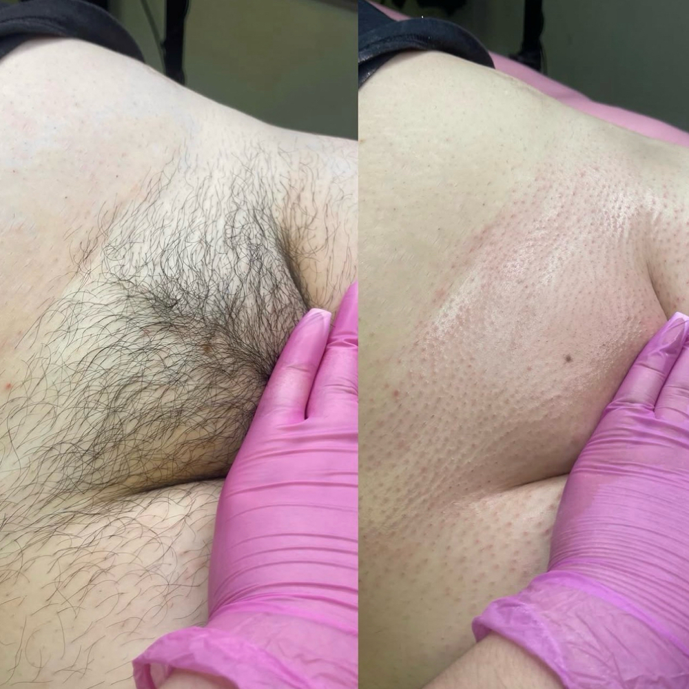 First Timer Brazilian