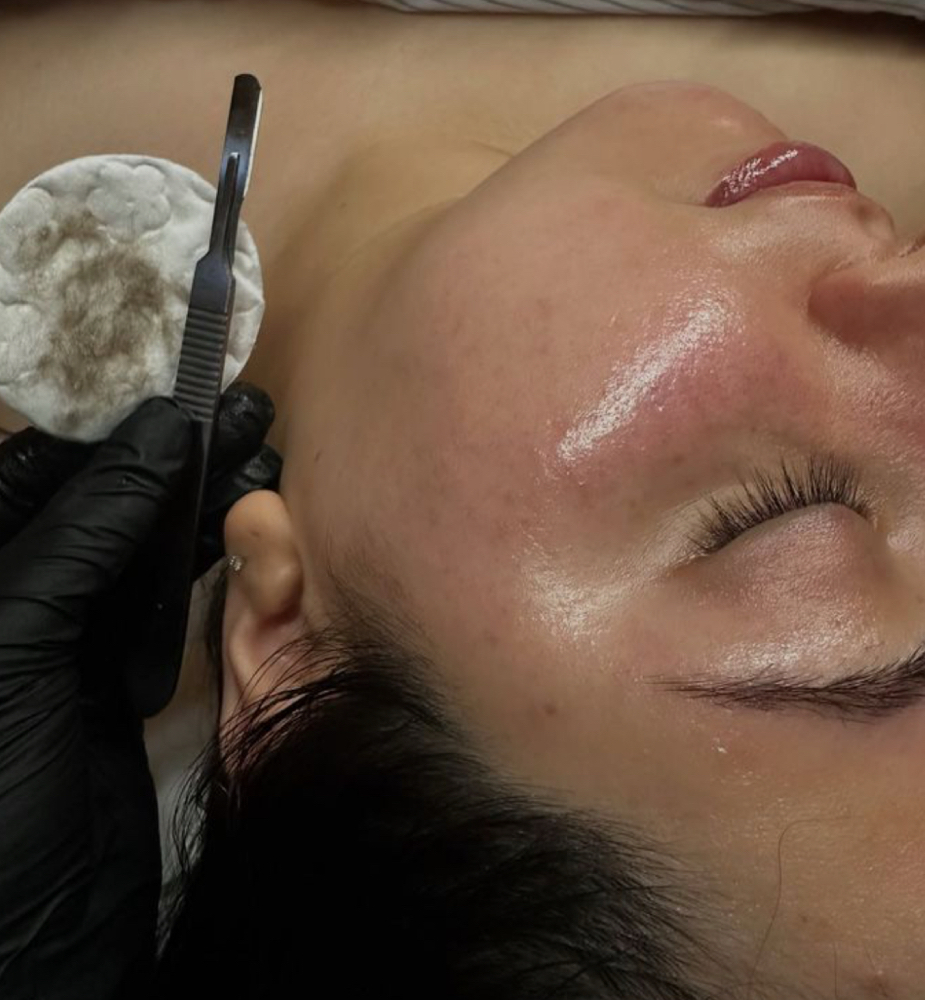Dermaplane Facial