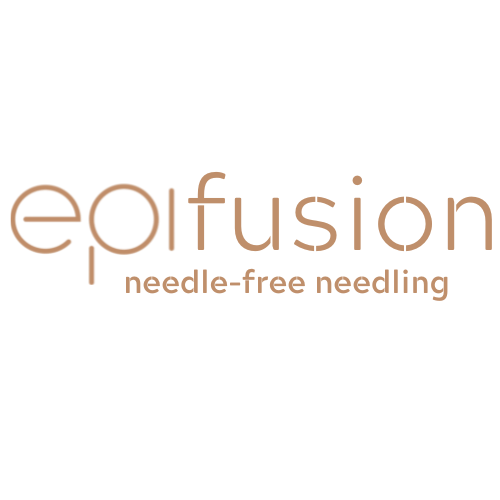 Epifusion