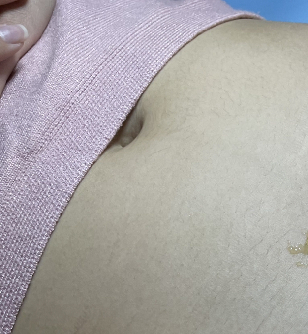 Full Stomach/ Belly Sugar Wax