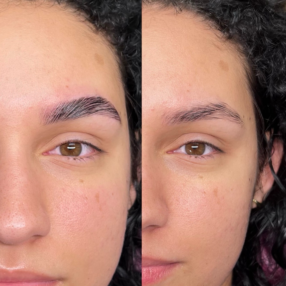 Full Brow Transformation at Escape Esthetics & Energy in Worcester, MA