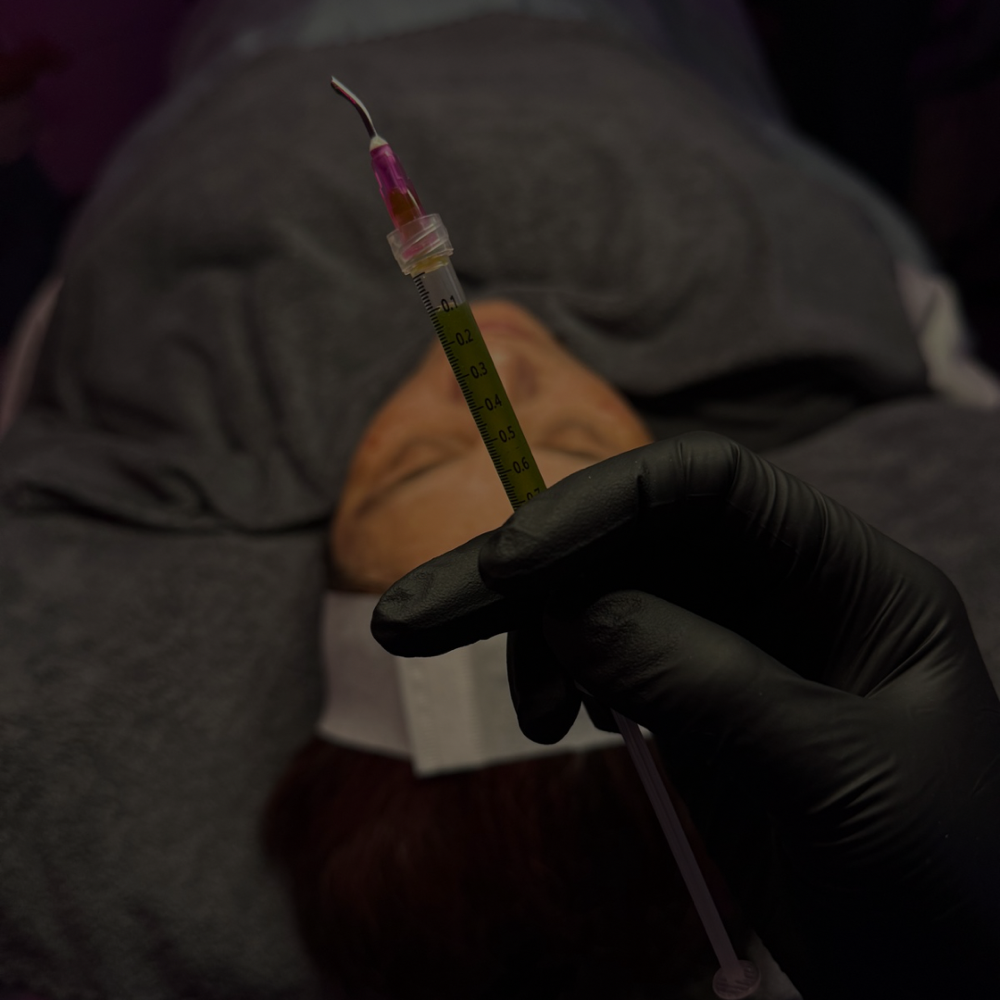 BioRePeel 4 Session Package