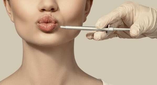 Half Plump -  1/2 Syringe