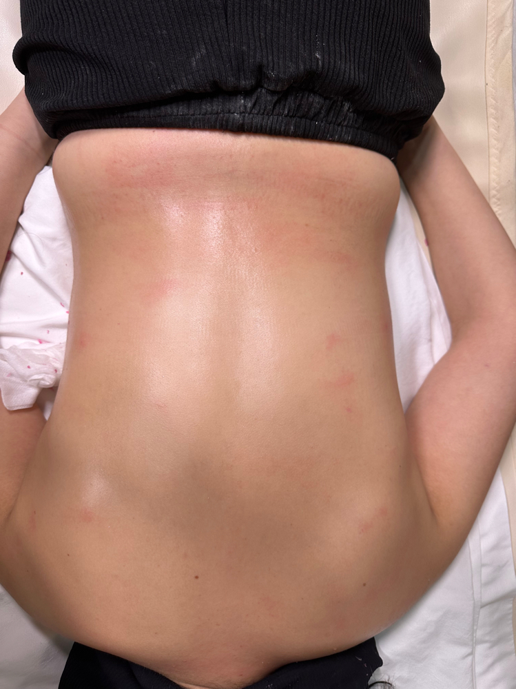 Back Wax