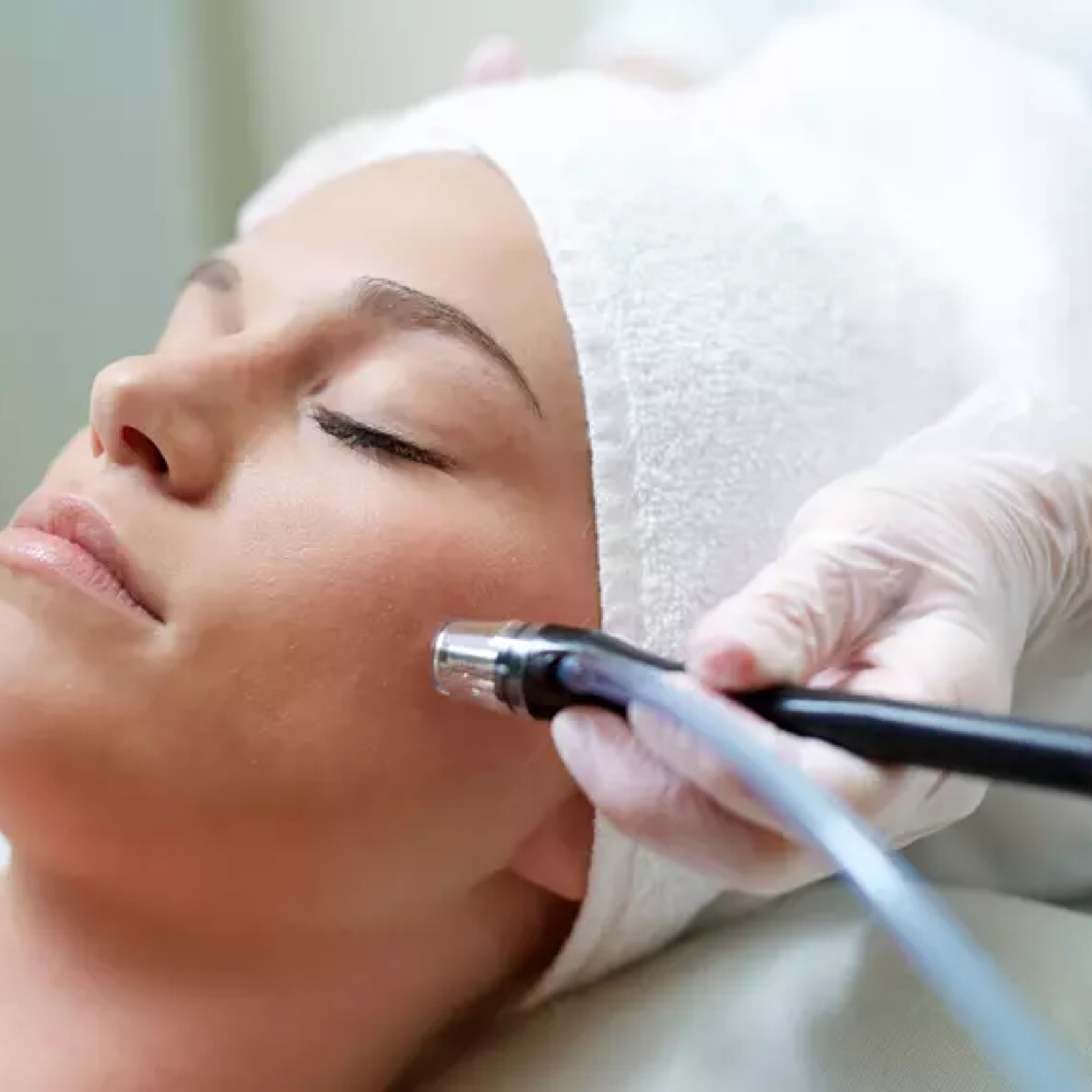 Microneedling at Beat Street Beauty Company in Bellflower, CA
