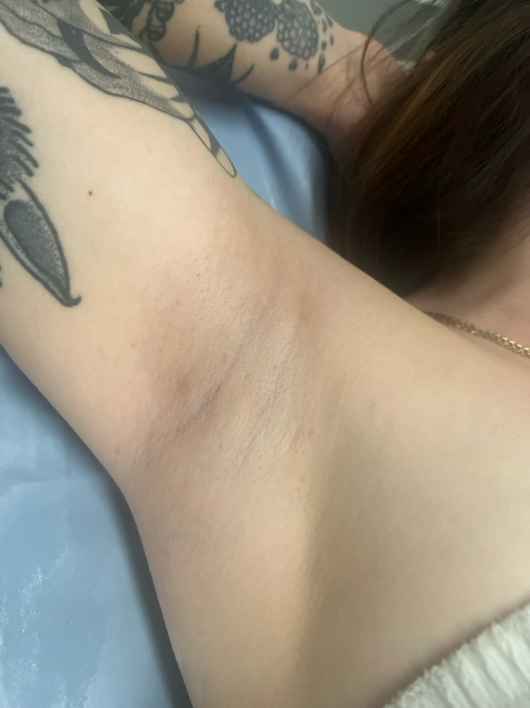 Underarm - Waxing