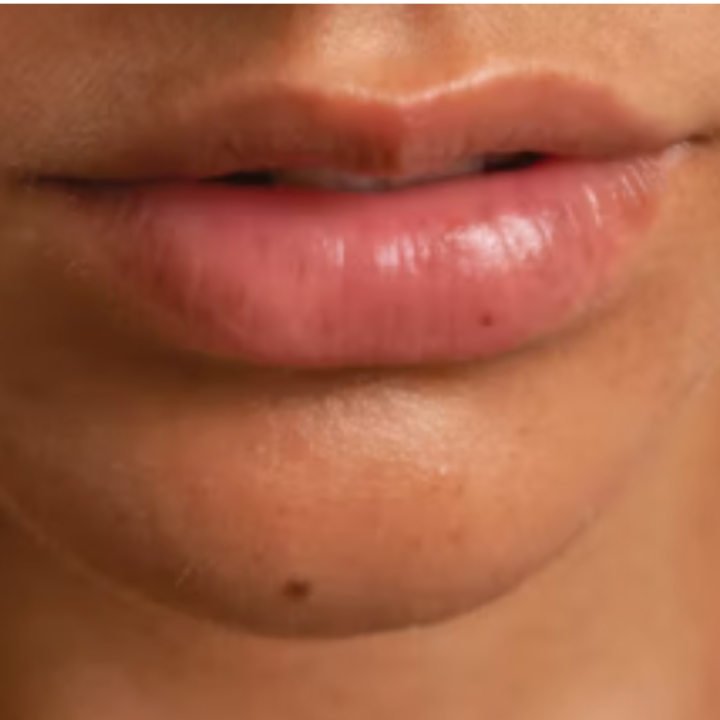 Upper Lip / Chin Waxing Enhancement at Elegant Esthetics in Virginia Beach, VA