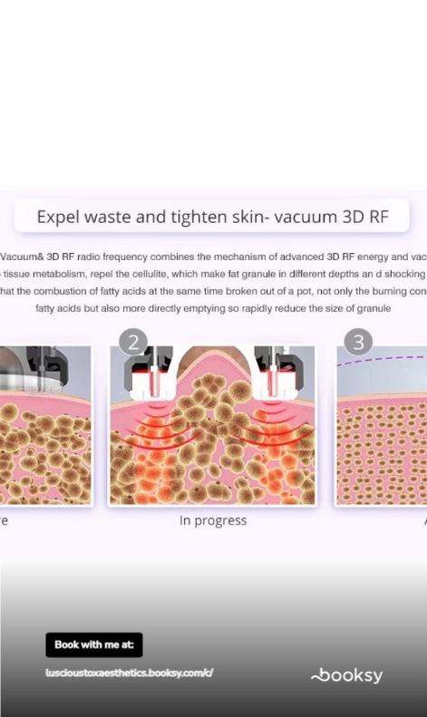 Vacuum Radio Frequency
