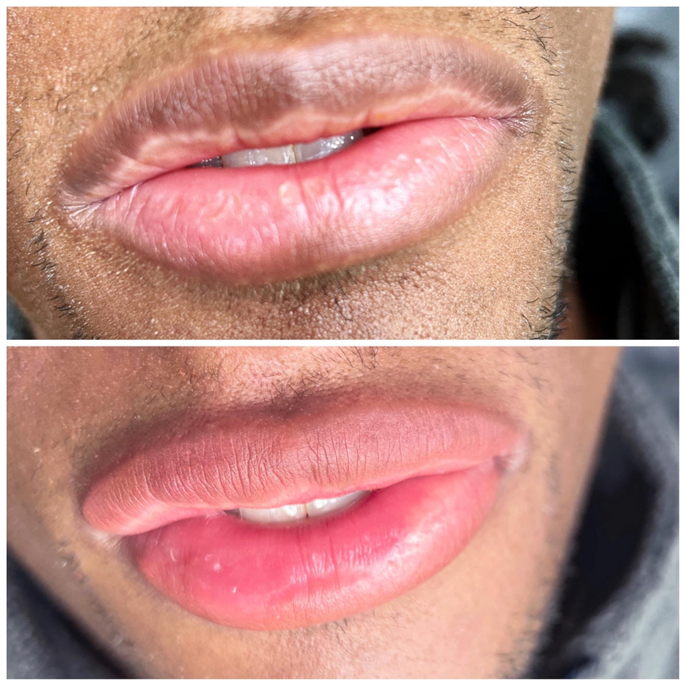 Lip Color Correction