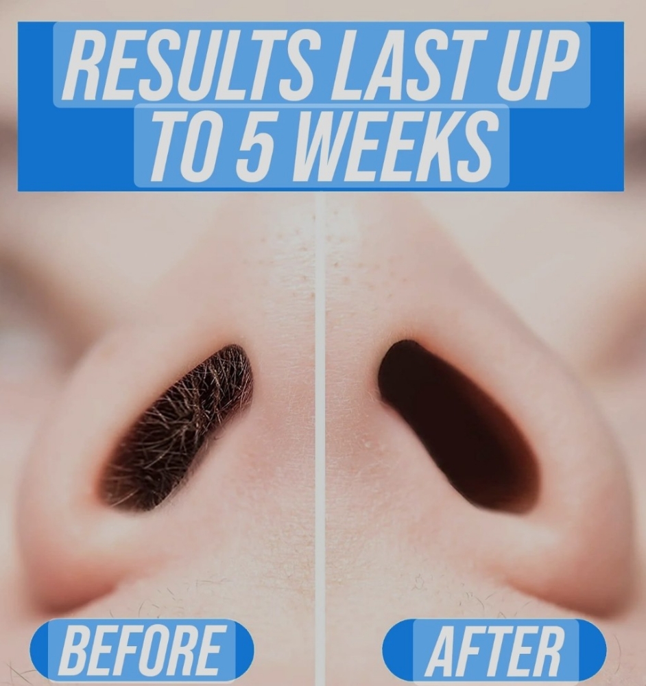Nose Hair Removal
