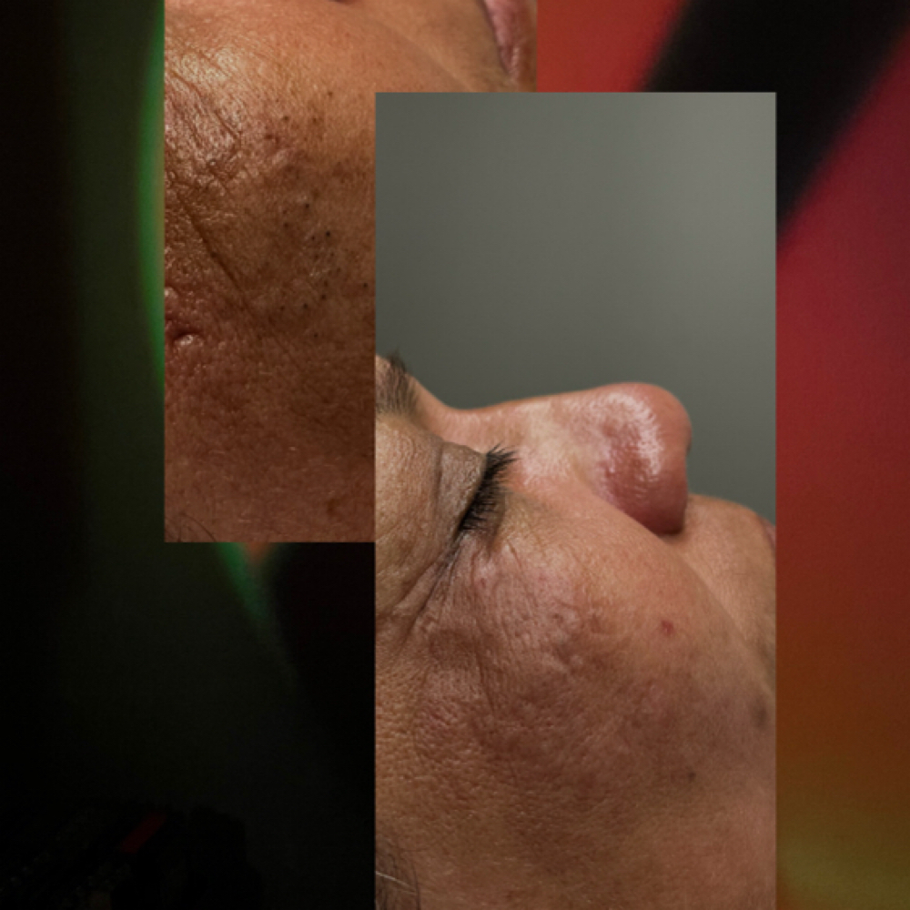 Microdermabrasion Facial at Destiny Benitez in Clovis, CA
