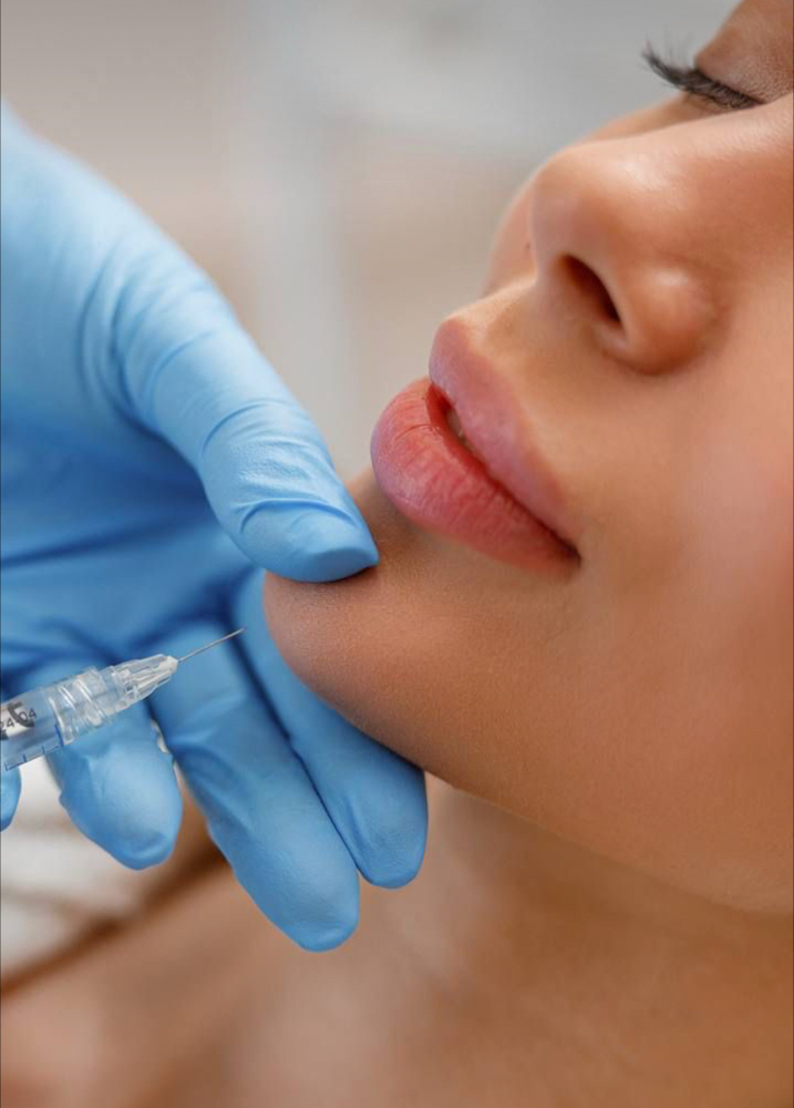 ✨Chin Lipolysis Package✨