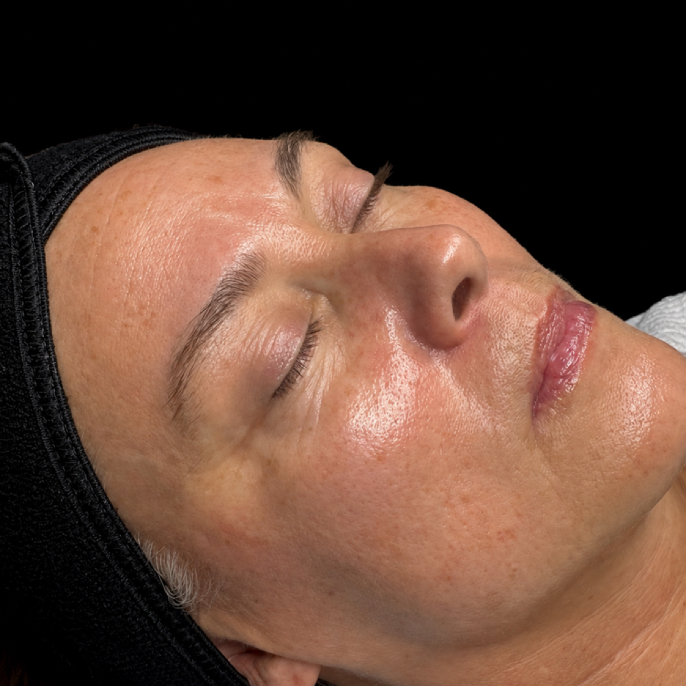 Signature Facial at Mindful Medical Spa LLC in Anniston, AL