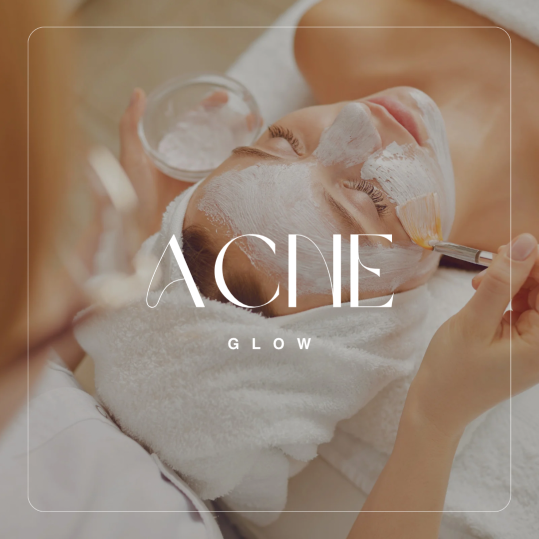 Acne Glow 🤍 at A GLOW in Metaire, LA