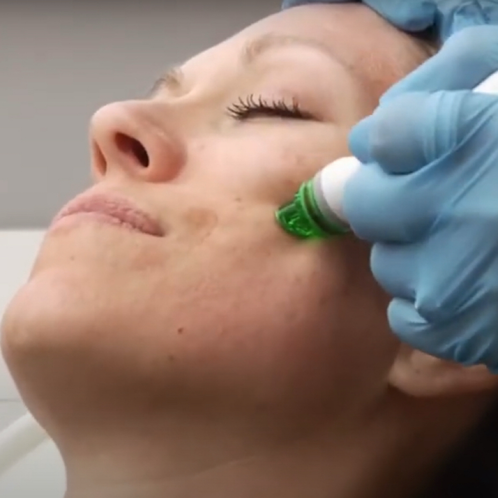 The MediSpa Gold Facial Experience at Vibe Skin Lab in Woburn, MA