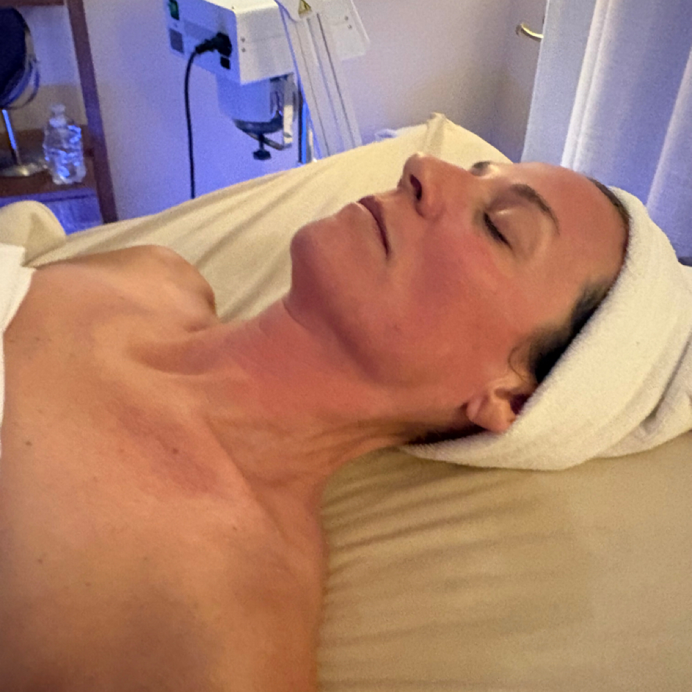 The Vibe Reset — Chemical Peel at Vibe Skin Lab in Woburn, MA