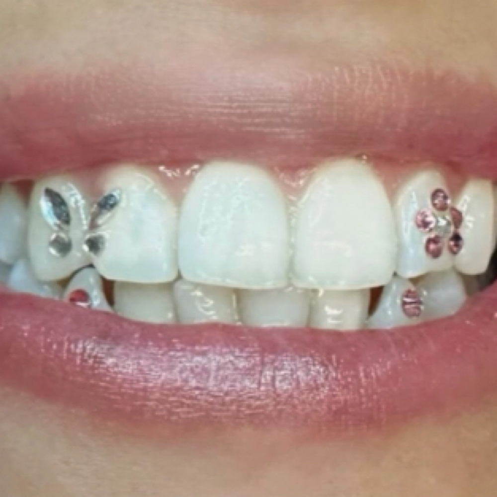 Tooth Gems at Magnolia Artistry in Draper, UT