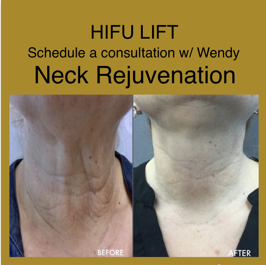 HUFU SKIN LIFT Half Neck