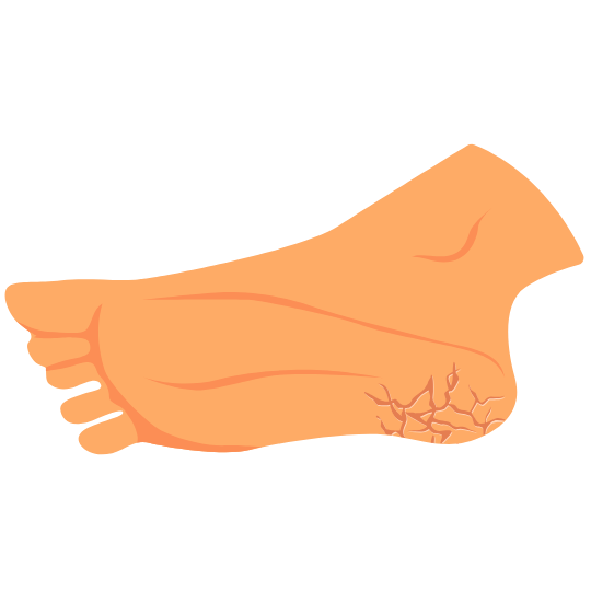 Heel Peel Service