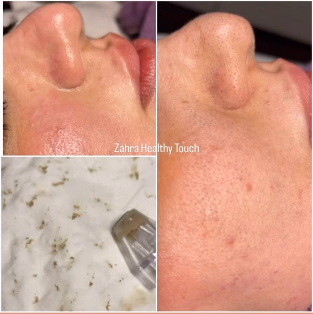 Regular Facial