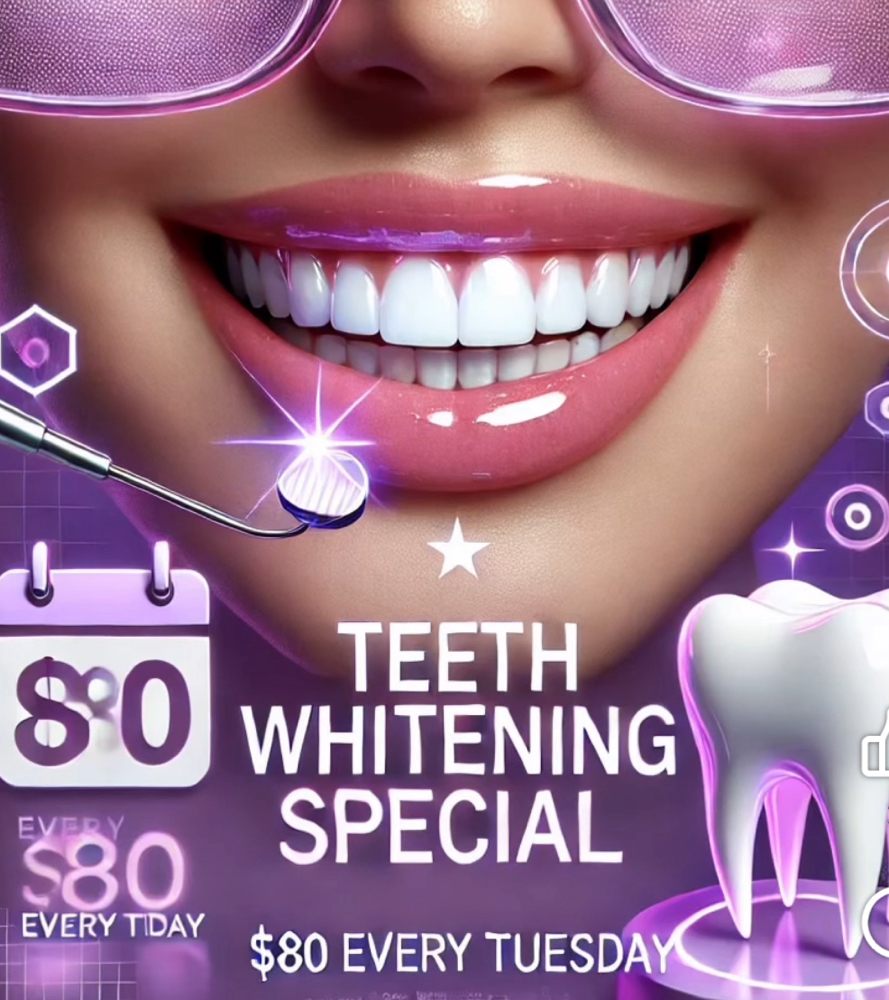 Teeth Whitening Tuesday Special