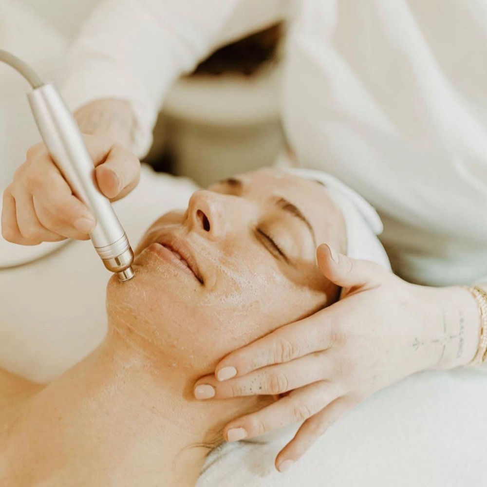 Diamond Microdermabrasion