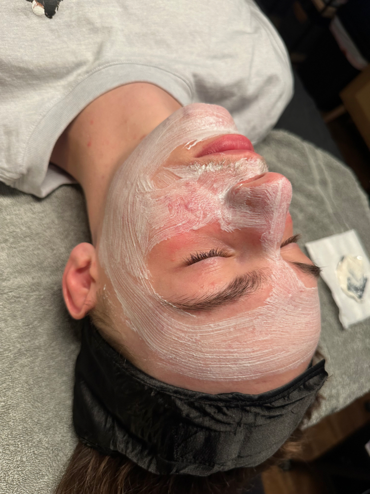 Acne Facial