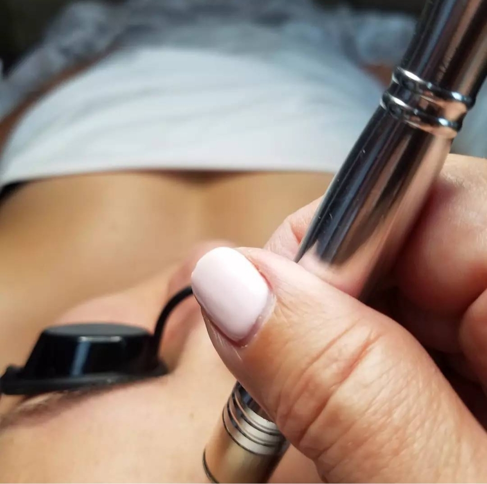 Microdermabrasion Add On
