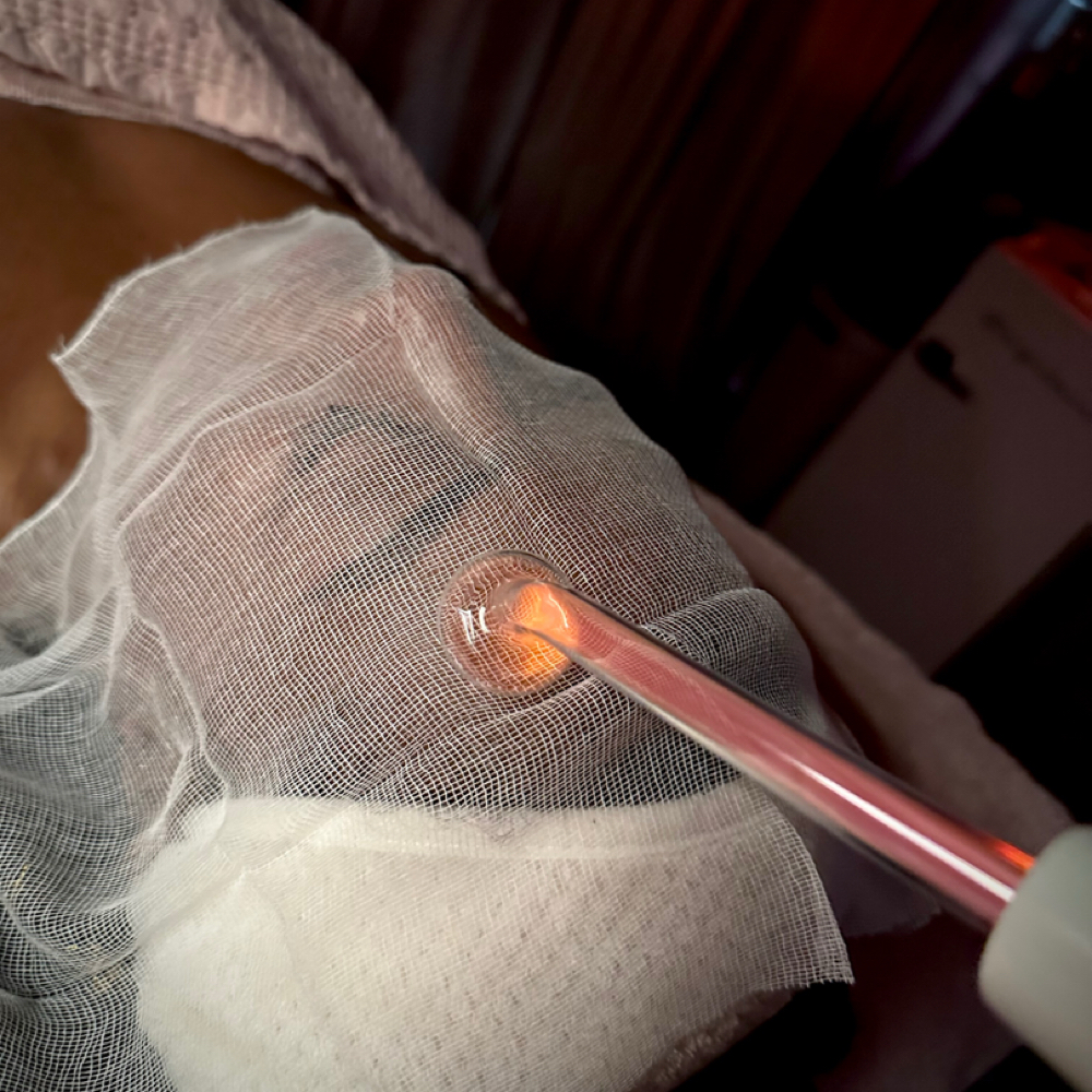 Facial Add On High Frequency