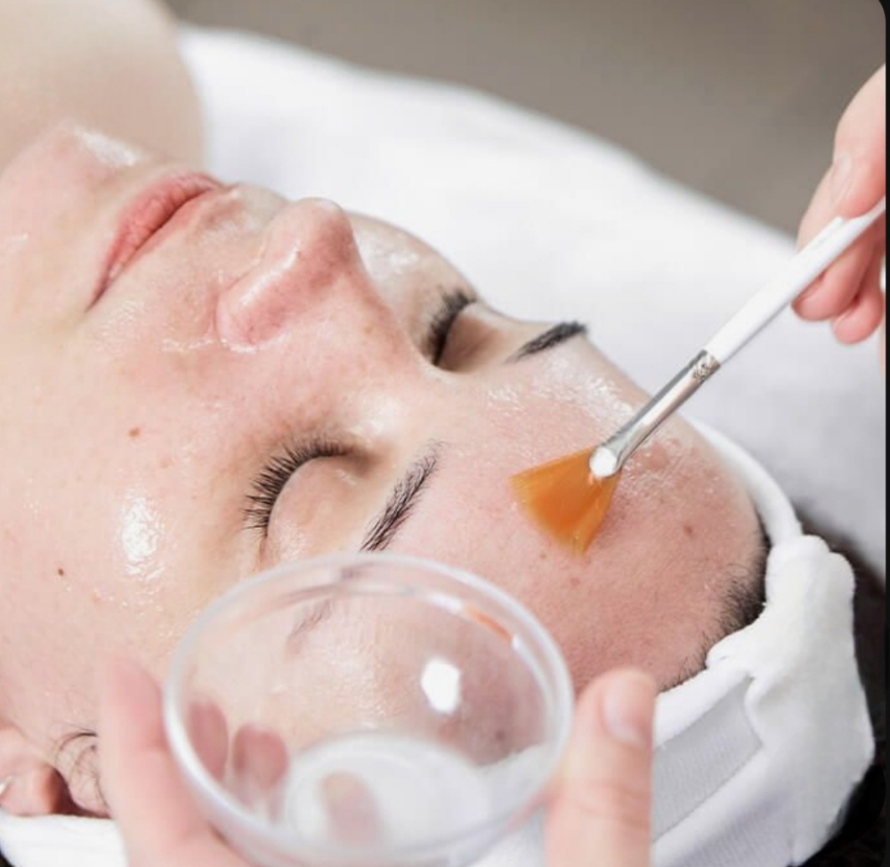 Chemical Peel